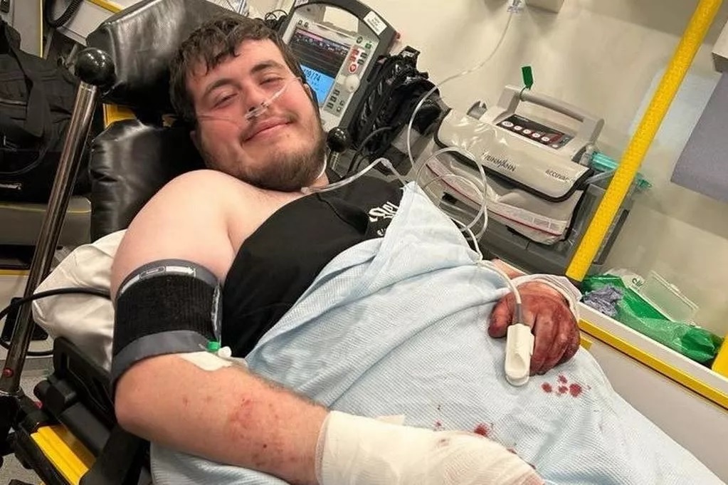 Elveszítette két újját a támadás során