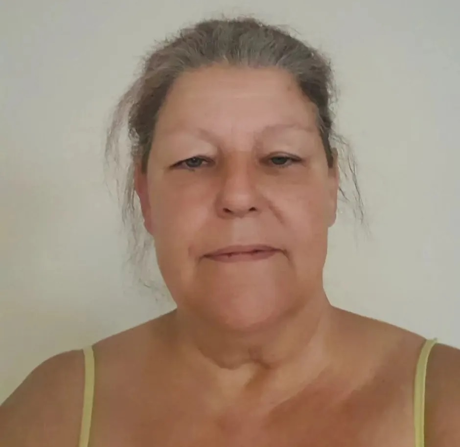 Amerikai bully fajtájú kutya támadt rá egy nőre